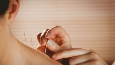 The Role of Acupuncture in Managing Pain and Promoting Healing