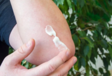 How Betamethasone Sodium Phosphate Helps Manage Skin Conditions?