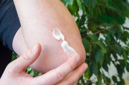 How Betamethasone Sodium Phosphate Helps Manage Skin Conditions?